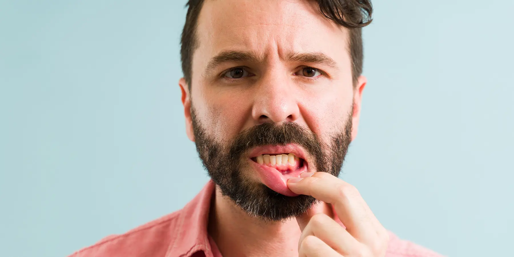 Stages of Gum Disease and How They Progress Over Time