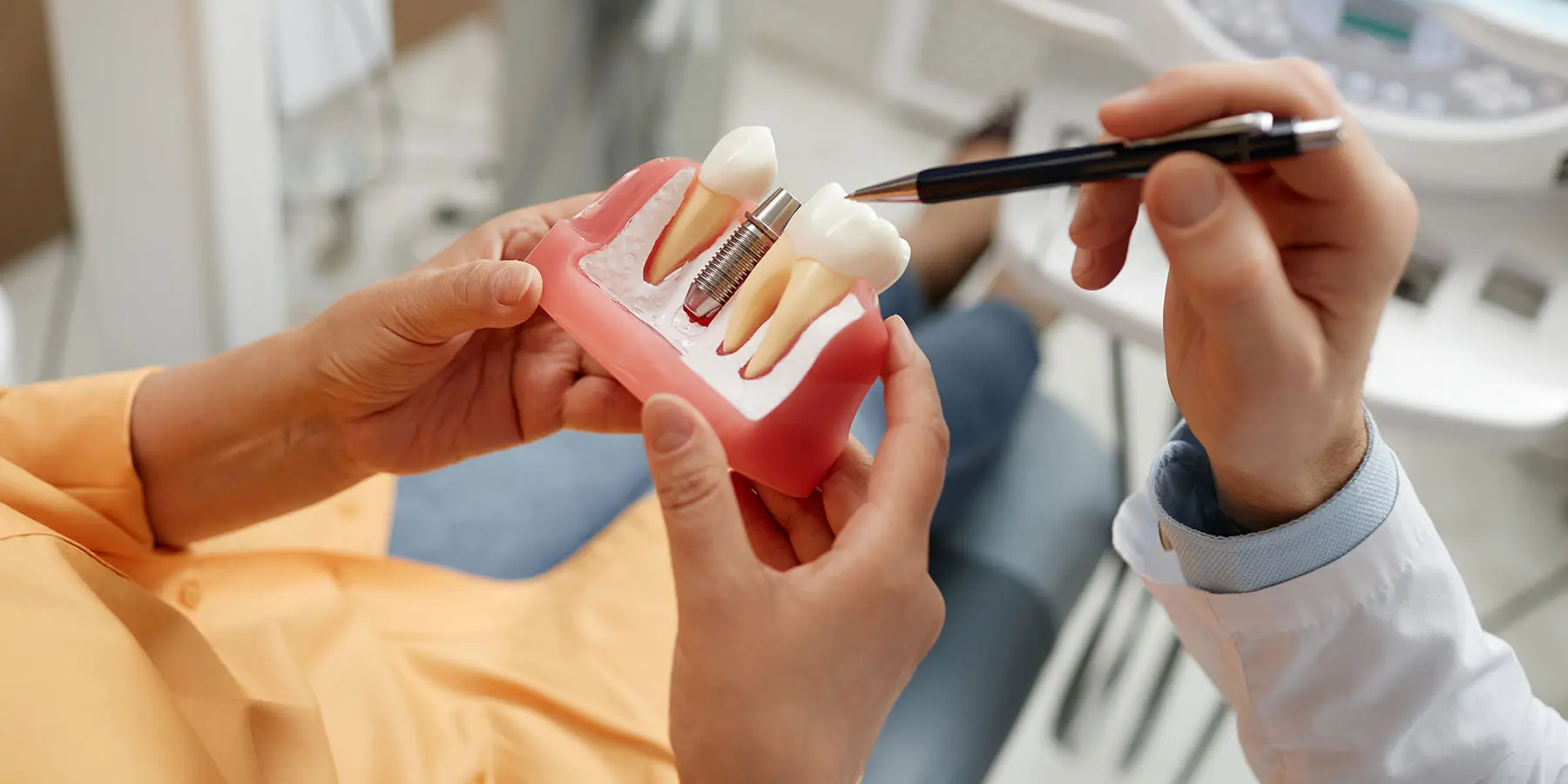 How Long Do Dental Implants Last?